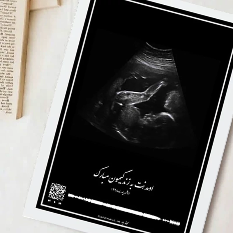 قاب موزیکال (سونوگرافی  و  بارکد صدای  ضربان قلب جنین شما  ) سایز  16.21