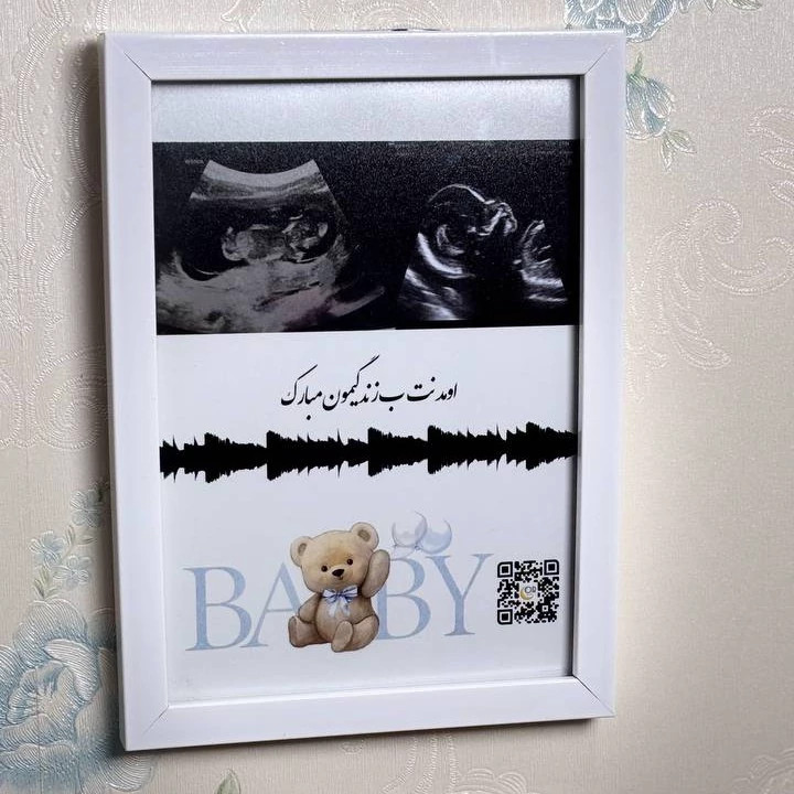 قاب موزیکال(سونوگرافی و بارکدصدای ضربان قلب جنین شما)سایز 16در21