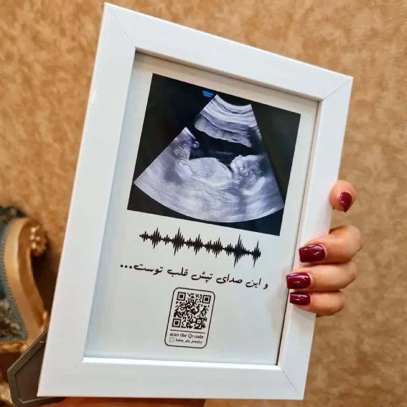 تابلو طرح سونو babyبا صدای ضربان قلب جنین یا ویس از خودتون