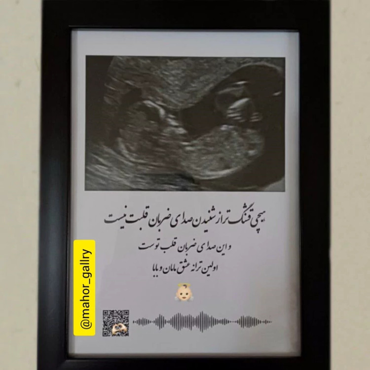 قاب عکس سونوگرافی و صدای ضربان قلب نوزاد