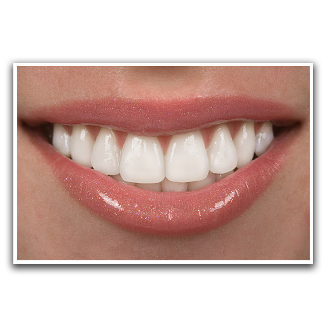 تابلو نوری بکلیت طرح لبخند مدل W-D1178